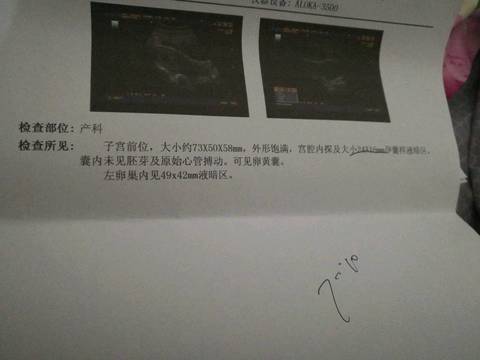 journal_insert_pic_713121864