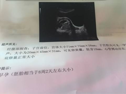 journal_insert_pic_712961257