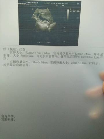 journal_insert_pic_713936721