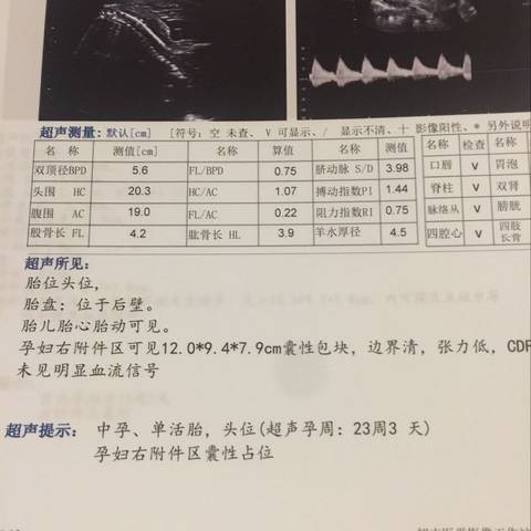 journal_insert_pic_715033294