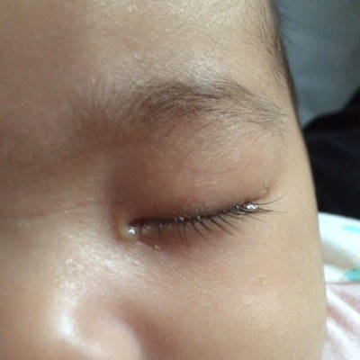 宝宝三个多月了,一哭眼睛就会流黄水一样的,不是很多干了就变成眼屎