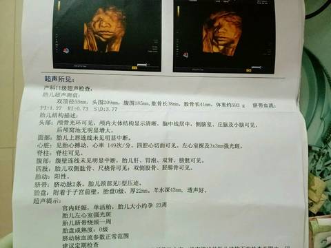 journal_insert_pic_715170703