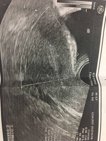 journal_insert_pic_716445802