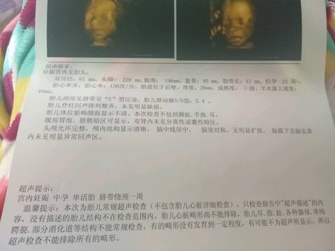 journal_insert_pic_717051471