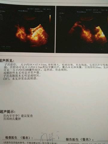 journal_insert_pic_720125141