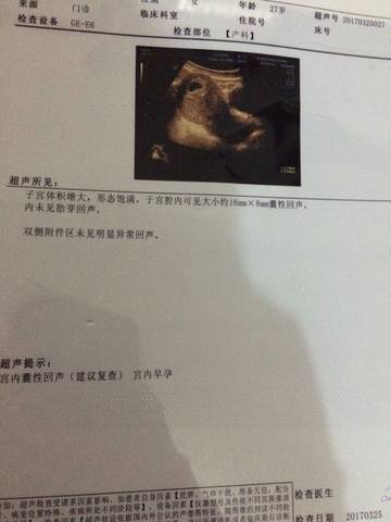 journal_insert_pic_720224699