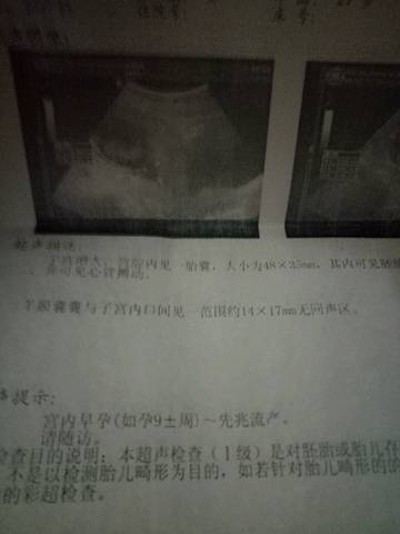 journal_insert_pic_720646345