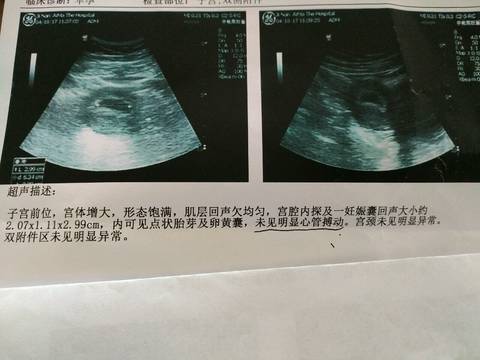 journal_insert_pic_721207145
