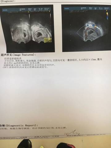 journal_insert_pic_721065711