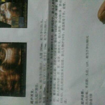 journal_insert_pic_722189393