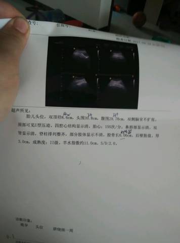 journal_insert_pic_721953080