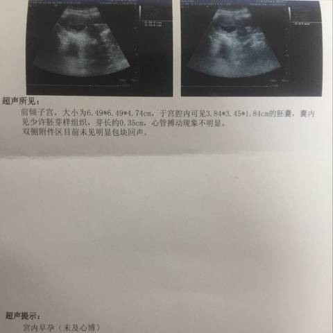 journal_insert_pic_722094292