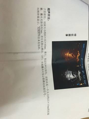 journal_insert_pic_721885141