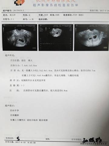 journal_insert_pic_723007156