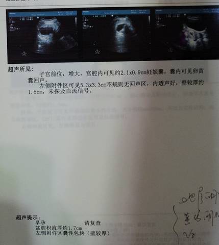 journal_insert_pic_723393845