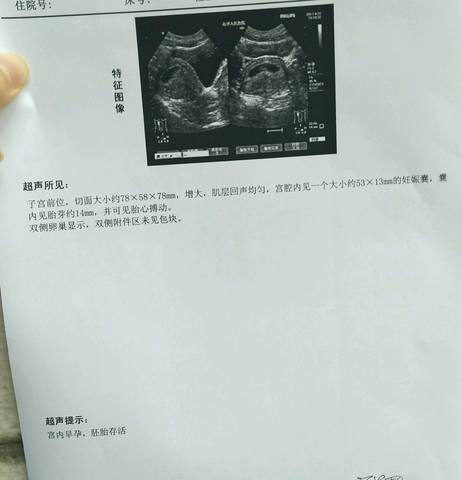 journal_insert_pic_724306584