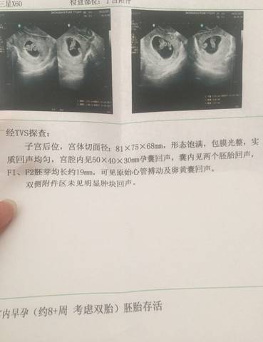 journal_insert_pic_724168701