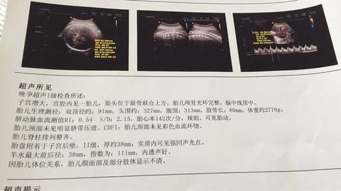 journal_insert_pic_724587723