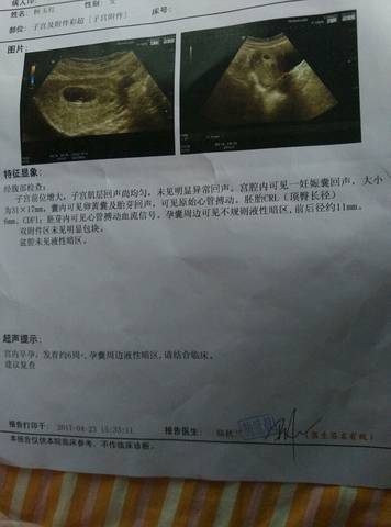 journal_insert_pic_725145335
