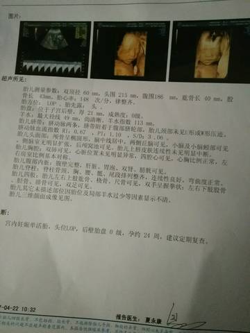 journal_insert_pic_725703652