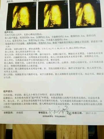 journal_insert_pic_726790138