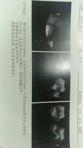 journal_insert_pic_733174221