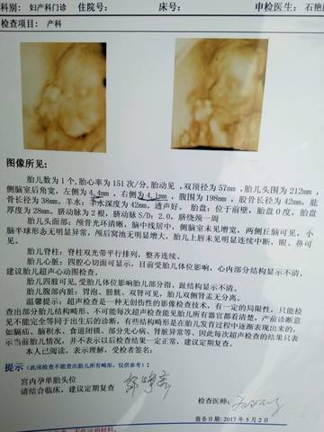 journal_insert_pic_733100985