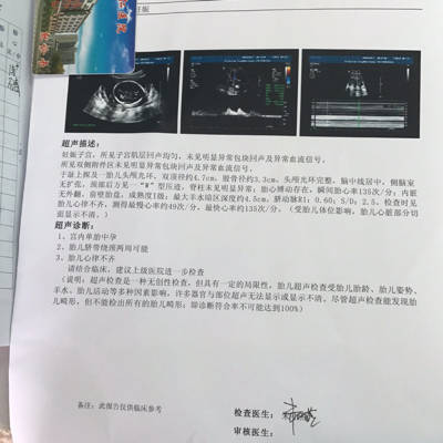 journal_insert_pic_732975808