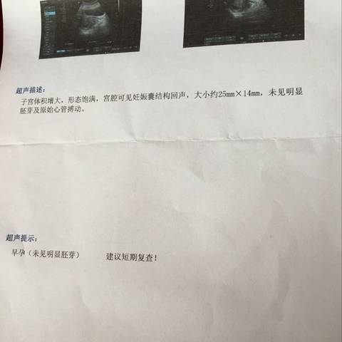 journal_insert_pic_734773226