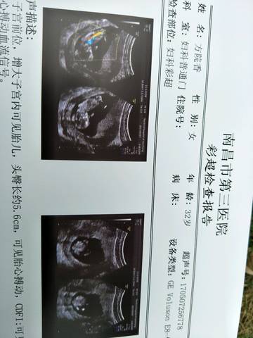 journal_insert_pic_736250278