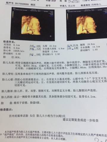 journal_insert_pic_737216004