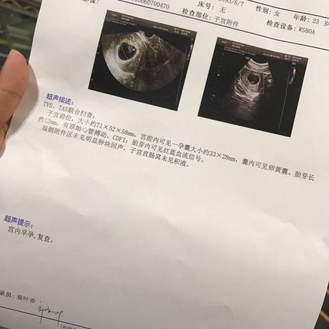 journal_insert_pic_737786208