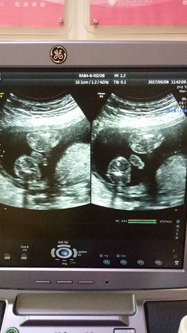 孕23周胎儿小鸡图图片