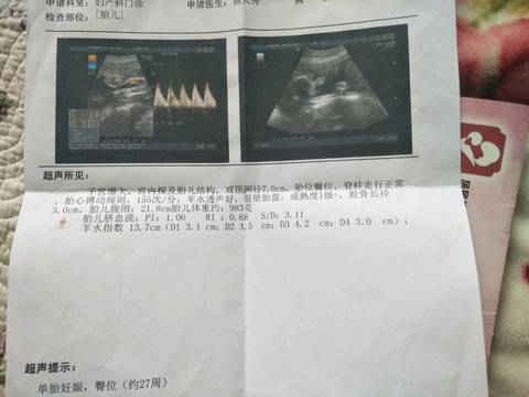 journal_insert_pic_739338241