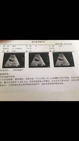 journal_insert_pic_739504919