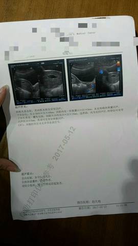journal_insert_pic_740255078