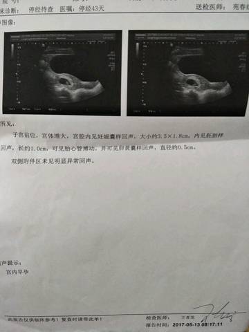 journal_insert_pic_740844935