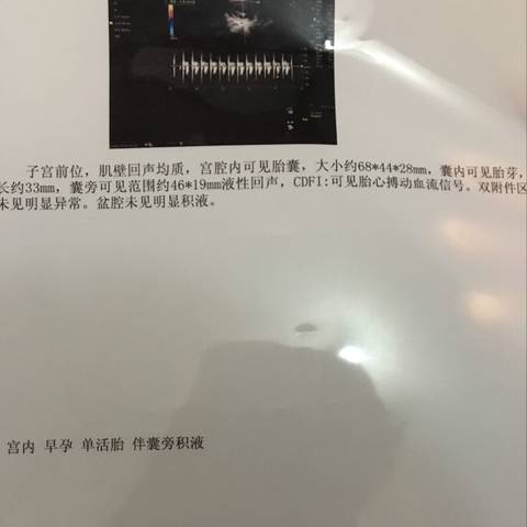 journal_insert_pic_741382532