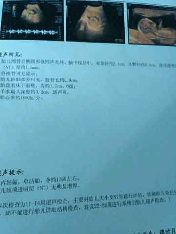 journal_insert_pic_743168924