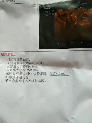 journal_insert_pic_743045391
