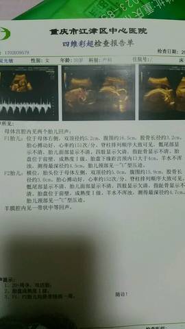 journal_insert_pic_743026911