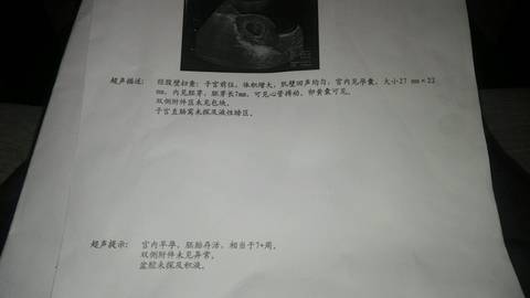 journal_insert_pic_743416395