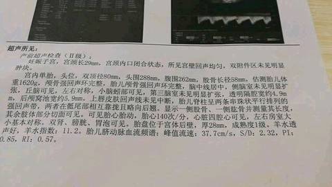 journal_insert_pic_743991246