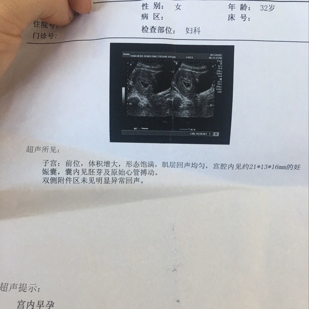 3月10日末次月经，58天测出有胎芽胎心，之后就感觉没啥反应