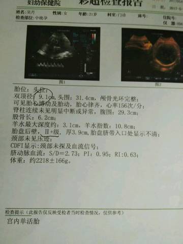 journal_insert_pic_744952441