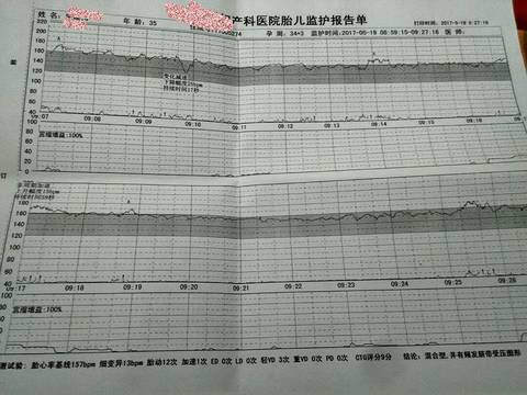 journal_insert_pic_745471747