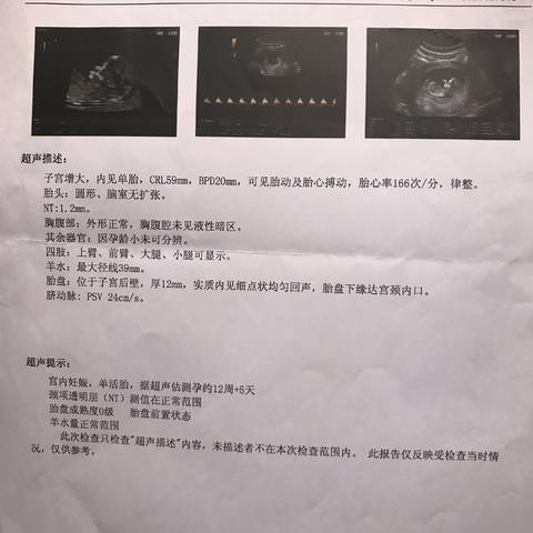 journal_insert_pic_745451577