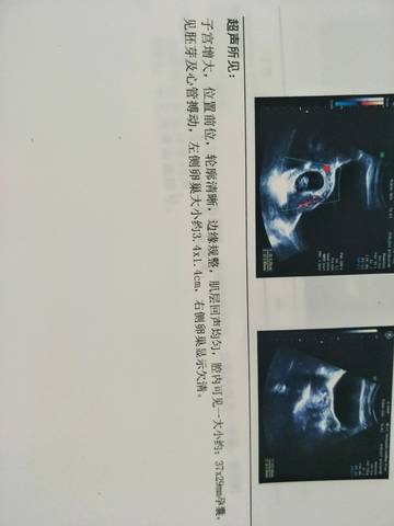 journal_insert_pic_745636001