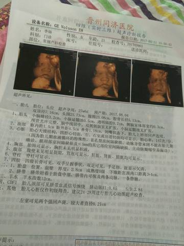 journal_insert_pic_745562343