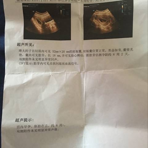 journal_insert_pic_745625271